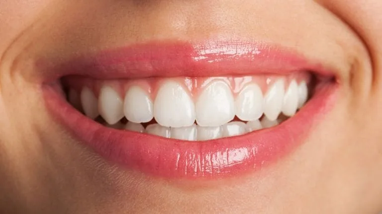 Invisalign teeth whitening Santa Clarita